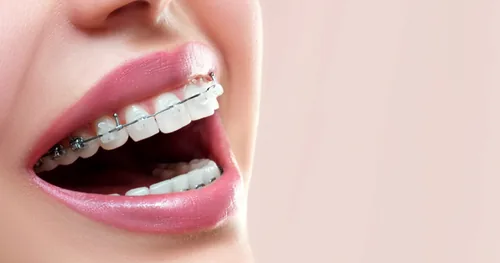 Ortodoncia y Spa Dental. Dra. Alejandra Osorio Chévez, consultorio dental en Cuernavaca, Morelos