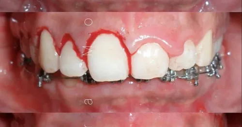 Dra Mayra Moreno – Ortodoncia Cuernavaca, consultorio dental en Cuernavaca, Morelos