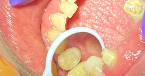 Orto +, consultorio dental en Oaxaca, Oaxaca