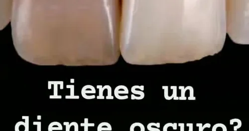 BG Dental Especializada en Santa Lucía del camino, consultorio dental en Oaxaca, Oaxaca