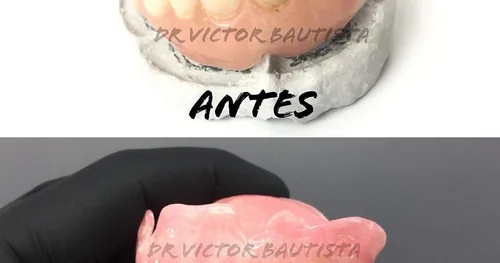 Dentista en Puebla Dentanium, consultorio dental en Puebla, Puebla