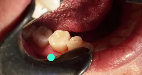 Odontología Preventiva AVIRUE, consultorio dental en Cholula, Puebla