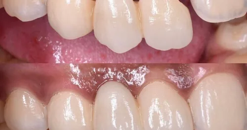 Amazing Dental – Dentista En Playa, consultorio dental en Playa del Carmen, Quintana Roo