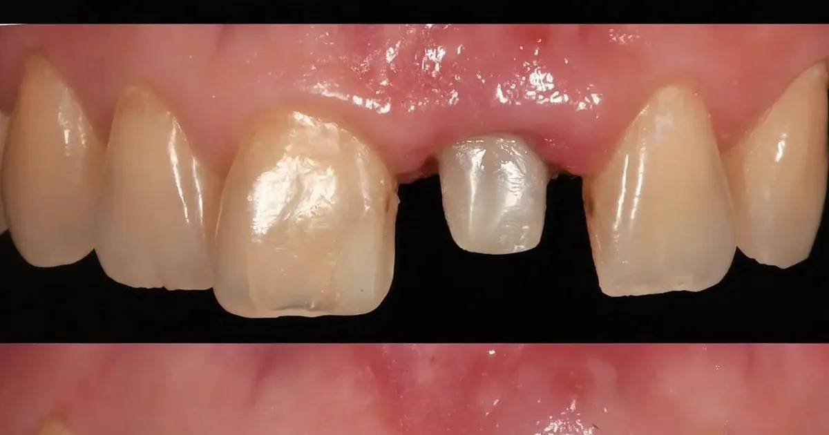 Dentch Dentista