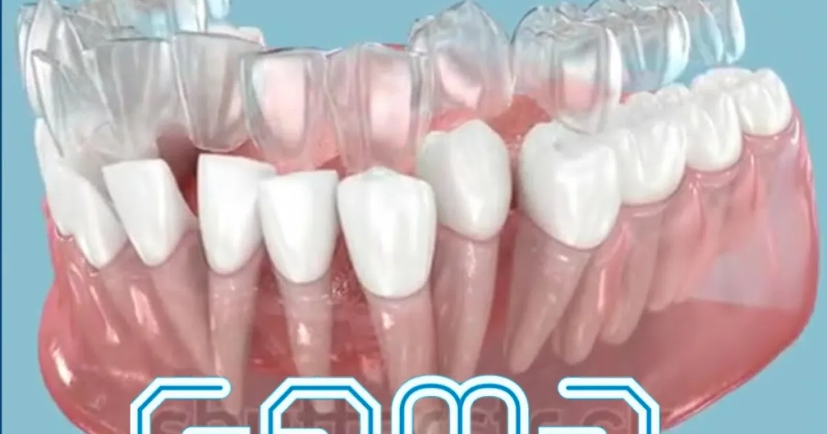 Gema, dentista, ortodoncia y Maxilofacial Tlaxcala