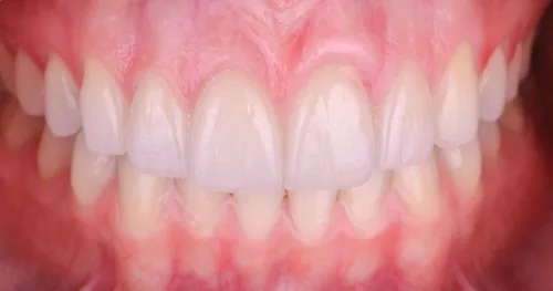 Dentista Gustavo Gaytán Salim, consultorio dental en Orizaba, Veracruz