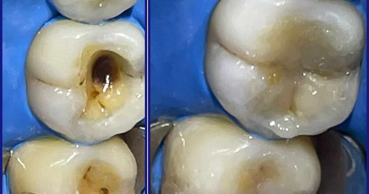 Dental VIDA – Dentista en Orizaba