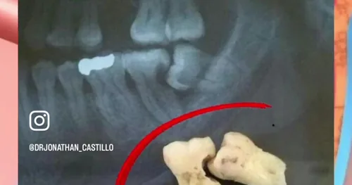 Clinica Dental Dr. Jonathan Castillo, consultorio dental en Veracruz, Veracruz