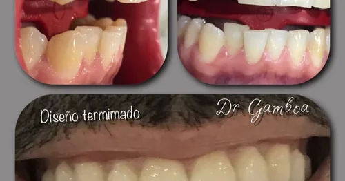 Clínica Dental DR.GAMBOA, consultorio dental en Veracruz, Veracruz