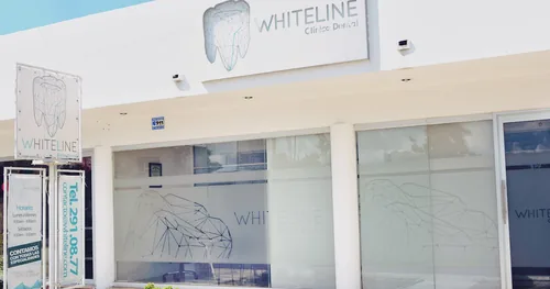 Whiteline Clínica Dental, consultorio dental en Mérida, Yucatán